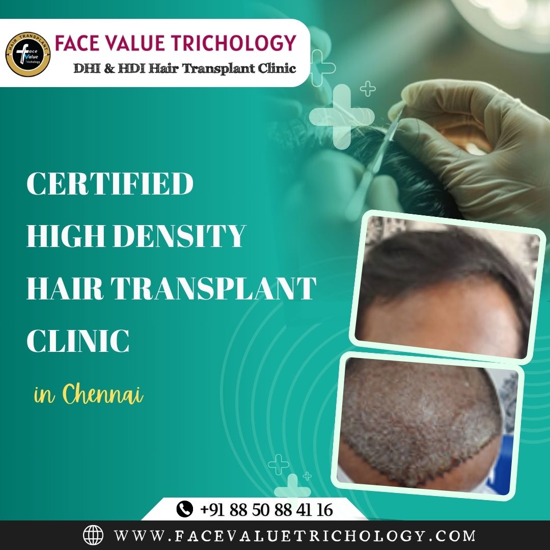 Certified High Density Hair Hransplant Clinic In Chennai