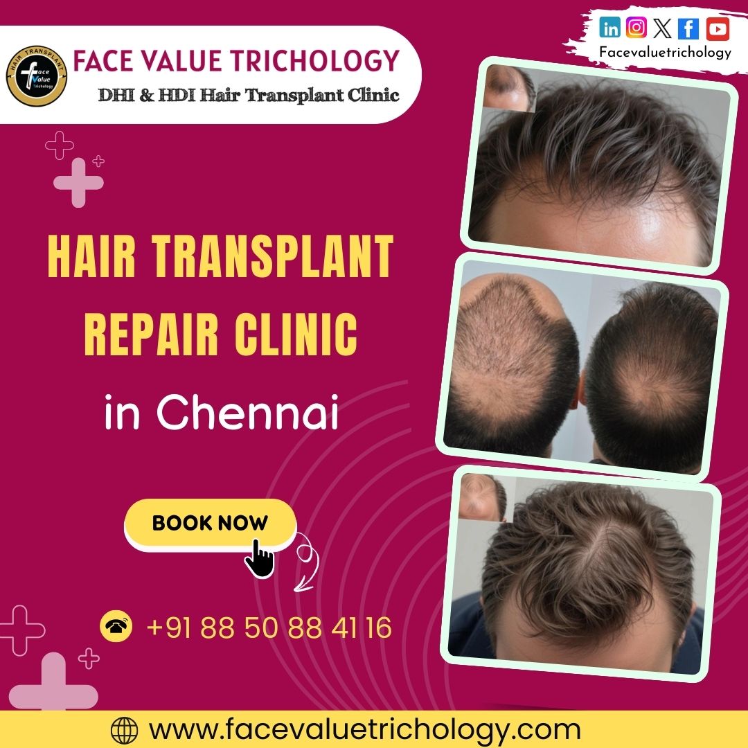 Hair Transplant Repair Clinic In Chennai