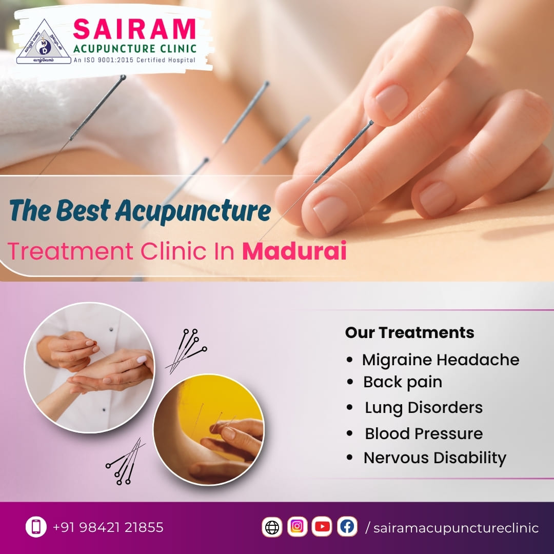 Best Acupuncture Treatment Clinic In Madurai