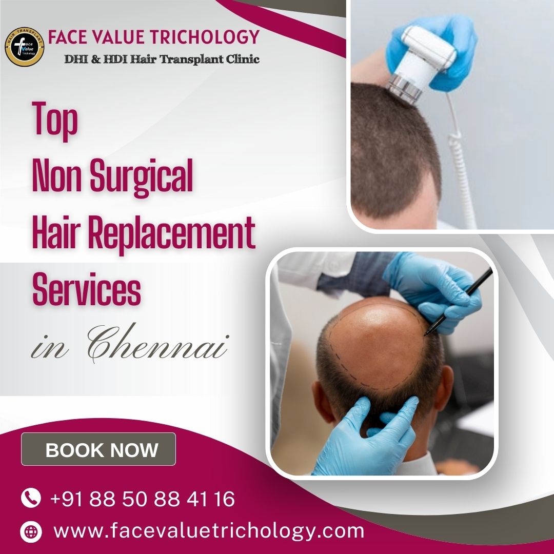 Top Non Surgical Hair Replacement Services In Chennai